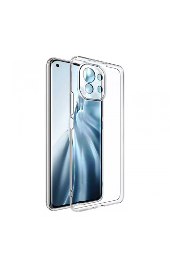 Xiaomi Mi 11 Lite Kılıf Kamera Korumalı Silikon Şeffaf Arka Kapak…