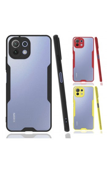 Xiaomi Mi 11 Lite Kılıf Platin Matte Silikon Arka Kapak&hellip;
